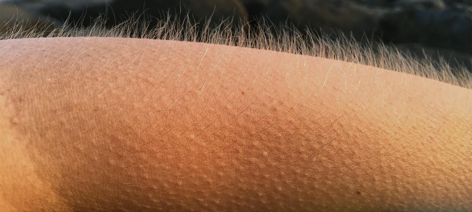 Por que o corpo arrepia sem motivo aparente - Imagem do artigo original