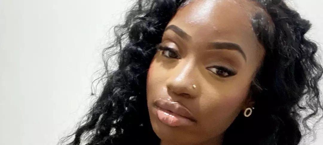 Adolescente de 19 anos tem pernas e dedos amputados após confundir infecção grave com gripe - Imagem do artigo original